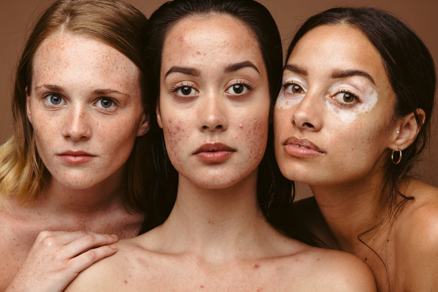 NEMA SAVRŠENE ŽENE: Evo koliko lošu kožu imaju VIP dame (VIDEO)
