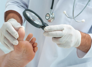 SIMPTOMI na koje morate da obratite pažnju! Gljivična infekcija NOKTIJU na stopalima nije samo ESTETSKI problem!