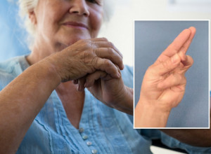 Za samo 7 sekundi saznajte da li patite od Alchajmerove bolesti! Prsti na šakama sve otkrivaju! (VIDEO)