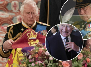 KRALJ ČARLS III TEŠKO BOLESTAN? Novi šok u Britaniji: Šta mu je se dešava sa šakama, jezive fotografije obilaze svet! (FOTO)