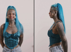 TELO JE PREKRILA TETOVAŽAMA, a onda je usledila šokantna transformacija! Pogledajte kako ova žena izgleda bez ijednog crteža na koži, ali njena reakcija zaprepašćuje! (VIDEO)