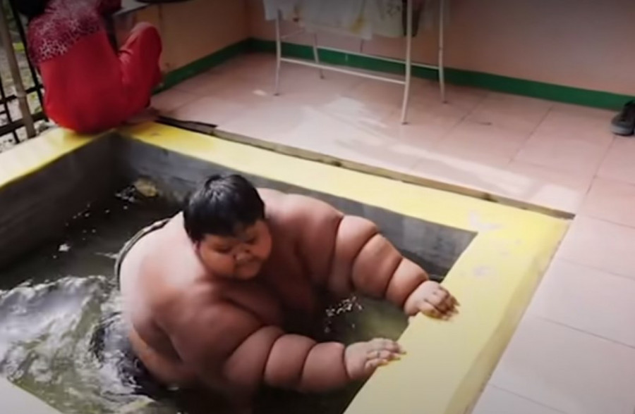 Roditelju su morali napolju da naprave bazen gde bi se kupao, pošto nije mogao da stane u tuš kabinu