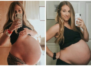 DA LI STE IKADA VIDELI VEĆI STOMAK? Na ultrazvučnom pregledu usledio je vrisak, pa neverica kada su videli koliko ova žena nosi beba! (FOTO)