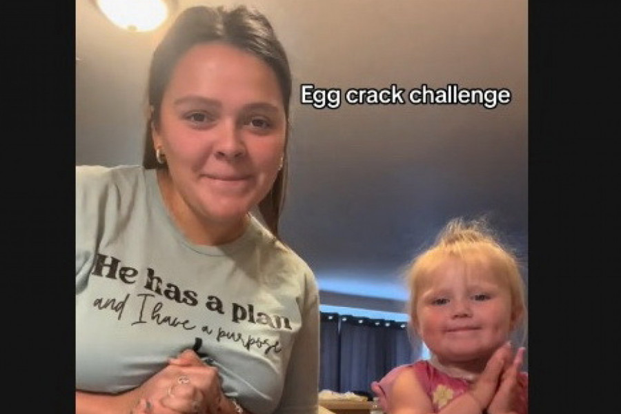 "JADNO DETE, IZGLEDA POVREĐENO": Ono što je ova majka uradila svojoj ćerkici izazvalo je burne reakcije javnosti, svi su se zabrinuli (VIDEO)