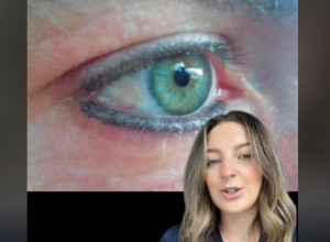 OVU ŠMINKU KORISTIMO SVAKODNEVNO, A MOŽE DA OŠTETI OČI: Oftamolog upozorava na štetnost ove kozmetike za ulepšavanje (VIDEO)