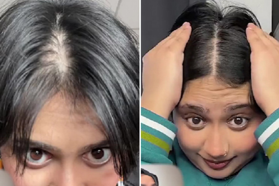 TVRDI DA SE REŠILA ĆELAVOSTI ZA TRI MESECA: Devojka podelila trik uz pomoć kojeg je njena kosa ponovo raste kao luda! (VIDEO)