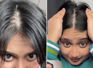 TVRDI DA SE REŠILA ĆELAVOSTI ZA TRI MESECA: Devojka podelila trik uz pomoć kojeg je njena kosa ponovo raste kao luda! (VIDEO)