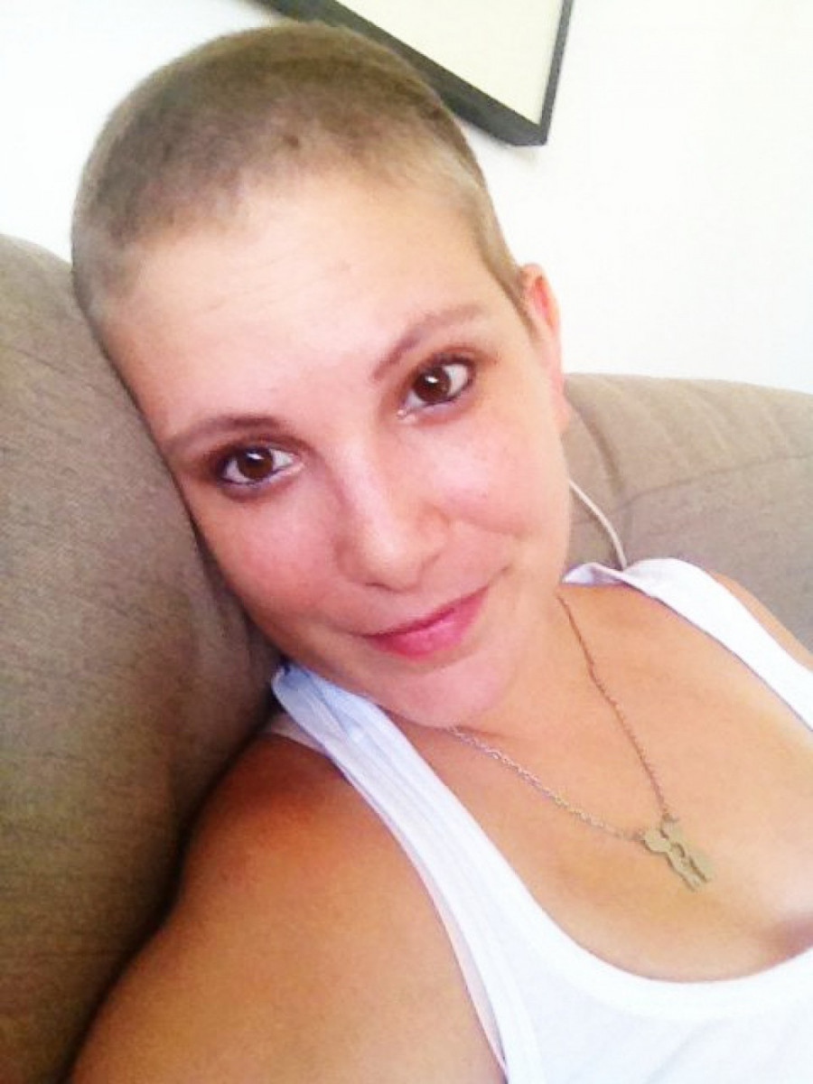 Kao i svakoj ženi i Neveni je najteže pao gubitak kose tokom hemioterapije