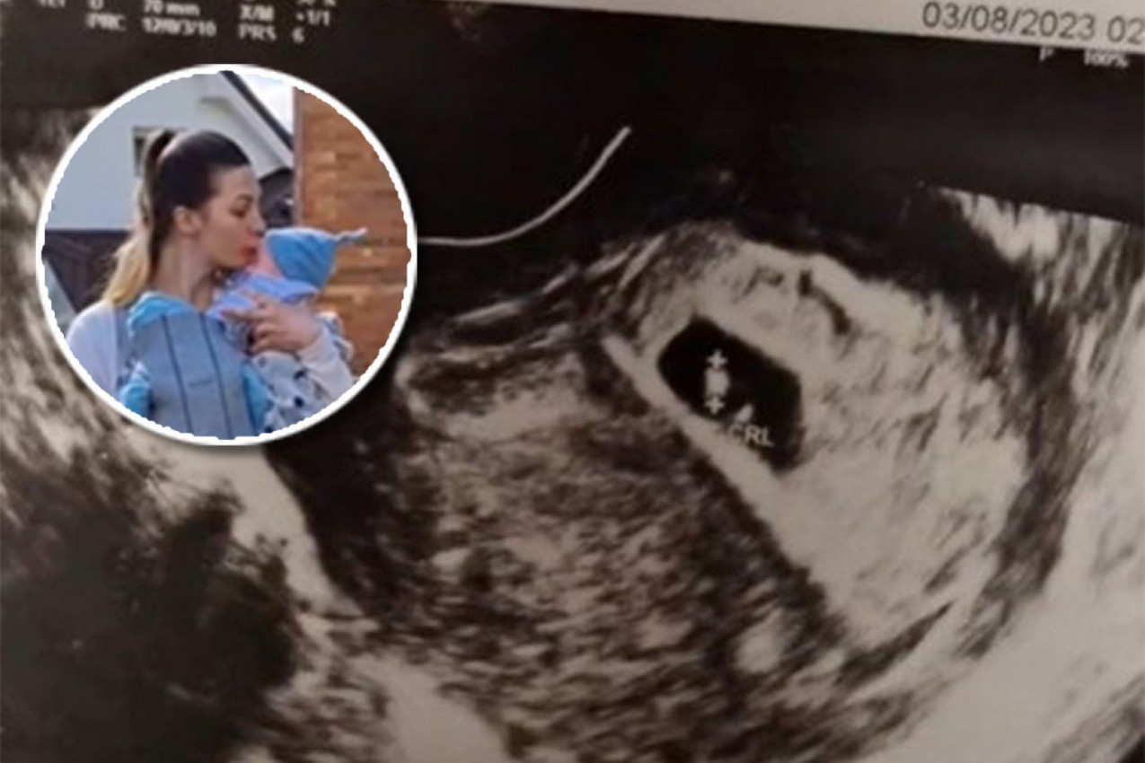MILANI SU REKLI DA ČEKA BLIZANCE: Kada se porodila nije mogla da dođe sebi od šoka, ovo nije očekivala (VIDEO)