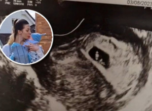 MILANI SU REKLI DA ČEKA BLIZANCE: Kada se porodila nije mogla da dođe sebi od šoka, ovo nije očekivala (VIDEO)