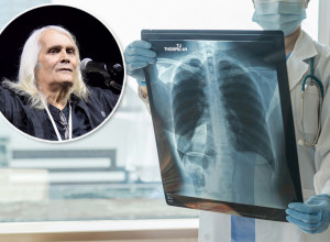 OD OVOGA BOLUJE BORA ČORBA - ŠTA JE OPSTRUKTIVNA BOLEST PLUĆA?  Čuveni roker na respiratoru - za sve je kriva ova navika