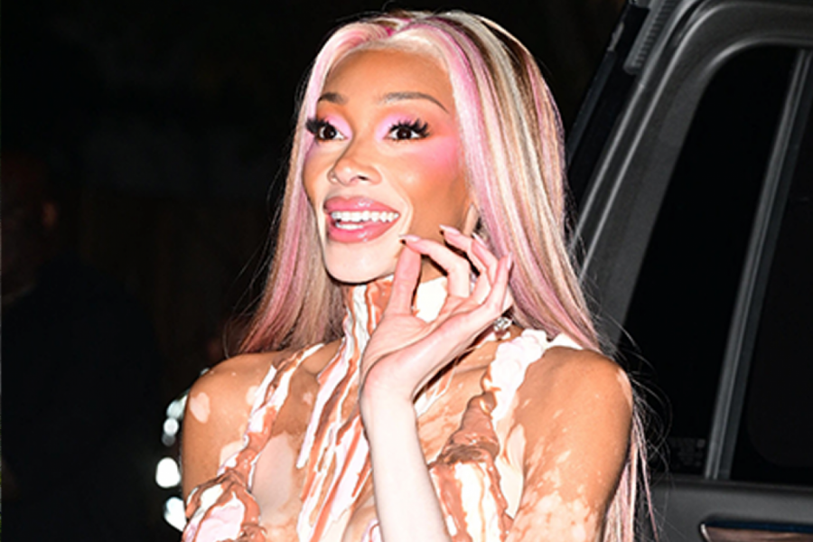 Ovo je MOĆAN kostim kojim je Vini Harlou posramila sve koji joj se rugaju zbog vitiliga